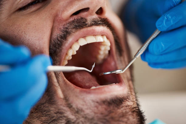 Best Emergency Tooth Extraction in Reynolds Heights, PA